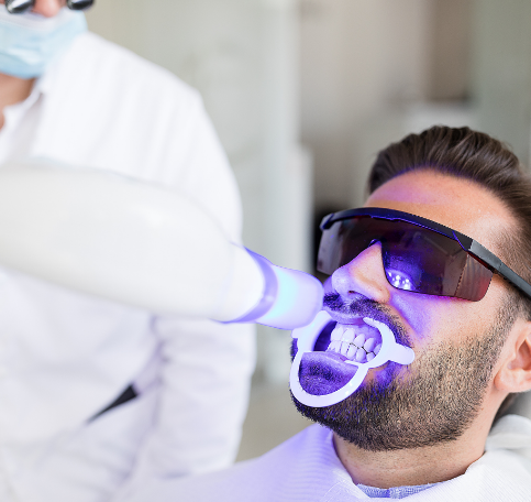Aligner Comparison